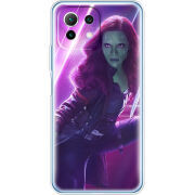 Чехол BoxFace  Xiaomi 11 Lite 5G NE 