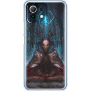 Чехол BoxFace  Xiaomi 11 Lite 5G NE 