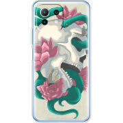 Чехол BoxFace  Xiaomi 11 Lite 5G NE 