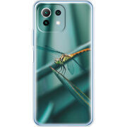 Чехол BoxFace  Xiaomi 11 Lite 5G NE 
