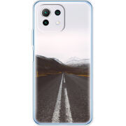 Чехол BoxFace  Xiaomi 11 Lite 5G NE 