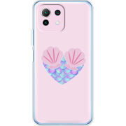 Чехол BoxFace  Xiaomi 11 Lite 5G NE 