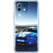 Чехол BoxFace  Xiaomi 11 Lite 5G NE 