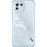 Чехол BoxFace  Xiaomi 11 Lite 5G NE 