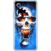 Чехол BoxFace  Xiaomi 11 Lite 5G NE 