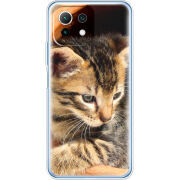 Чехол BoxFace  Xiaomi 11 Lite 5G NE 