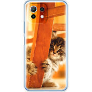 Чехол BoxFace  Xiaomi 11 Lite 5G NE 