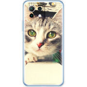 Чехол BoxFace  Xiaomi 11 Lite 5G NE 