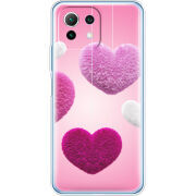 Чехол BoxFace  Xiaomi 11 Lite 5G NE 