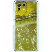 Чехол BoxFace  Xiaomi 11 Lite 5G NE 