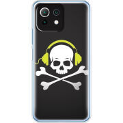 Чехол BoxFace  Xiaomi 11 Lite 5G NE 