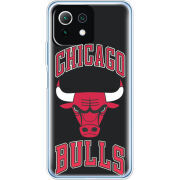 Чехол BoxFace  Xiaomi 11 Lite 5G NE 