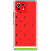 Чехол BoxFace  Xiaomi 11 Lite 5G NE 