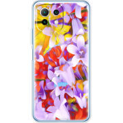 Чехол BoxFace  Xiaomi 11 Lite 5G NE 