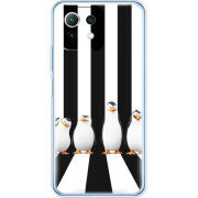 Чехол BoxFace  Xiaomi 11 Lite 5G NE 