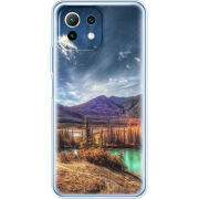 Чехол BoxFace  Xiaomi 11 Lite 5G NE 