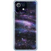 Чехол BoxFace  Xiaomi 11 Lite 5G NE 