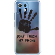 Чехол BoxFace  Xiaomi 11 Lite 5G NE 