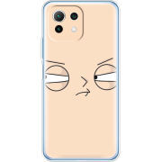Чехол BoxFace  Xiaomi 11 Lite 5G NE 