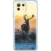 Чехол BoxFace  Xiaomi 11 Lite 5G NE 