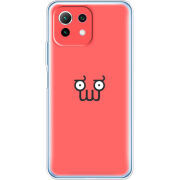 Чехол BoxFace  Xiaomi 11 Lite 5G NE 