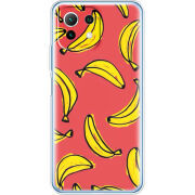 Чехол BoxFace  Xiaomi 11 Lite 5G NE 