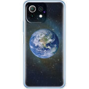 Чехол BoxFace  Xiaomi 11 Lite 5G NE 