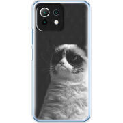 Чехол BoxFace  Xiaomi 11 Lite 5G NE 