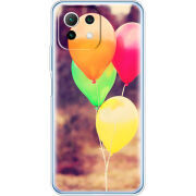 Чехол BoxFace  Xiaomi 11 Lite 5G NE 