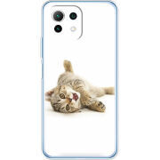 Чехол BoxFace  Xiaomi 11 Lite 5G NE 