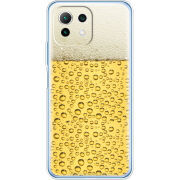 Чехол BoxFace  Xiaomi 11 Lite 5G NE 