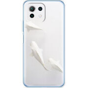 Чехол BoxFace  Xiaomi 11 Lite 5G NE 