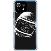 Чехол BoxFace  Xiaomi 11 Lite 5G NE 