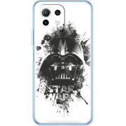 Чехол BoxFace  Xiaomi 11 Lite 5G NE 