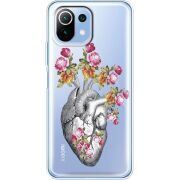 Чехол BoxFace со стразами Xiaomi 11 Lite 5G NE Heart