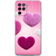 Чехол BoxFace OPPO Reno5 Lite 