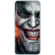 Чехол BoxFace Xiaomi Redmi Note 11 Pro / Note 11 Pro 5G Prankster