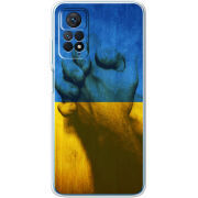 Чехол BoxFace Xiaomi Redmi Note 11 Pro / Note 11 Pro 5G Handshake