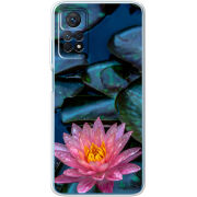 Чехол BoxFace Xiaomi Redmi Note 11 Pro / Note 11 Pro 5G 