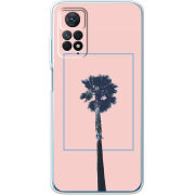 Чехол BoxFace Xiaomi Redmi Note 11 Pro / Note 11 Pro 5G 