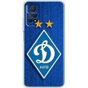 Чехол BoxFace Xiaomi Redmi Note 11 Pro / Note 11 Pro 5G Динамо Киев