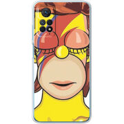 Чехол BoxFace Xiaomi Redmi Note 11 Pro / Note 11 Pro 5G 