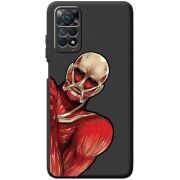 Черный чехол BoxFace Xiaomi Redmi Note 11 Pro / Note 11 Pro 5G Титан