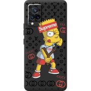 Черный чехол BoxFace Vivo V21 Yellow Fun