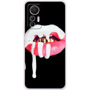 Чехол BoxFace Xiaomi 12 Lite 