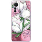 Чехол BoxFace Xiaomi 12 Lite 