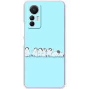 Чехол BoxFace Xiaomi 12 Lite 