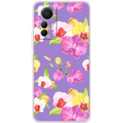 Чехол BoxFace Xiaomi 12 Lite 