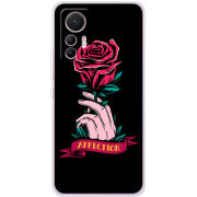 Чехол BoxFace Xiaomi 12 Lite 