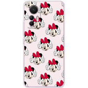 Чехол BoxFace Xiaomi 12 Lite 